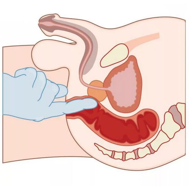 Lokalisierung des männlichen G-Punkts